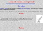 Lesions de l'aparell locomotor | Recurso educativo 35162