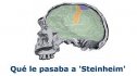 Qué le pasaba a "Steinheim" | Recurso educativo 55261